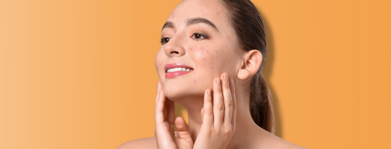 rutina-facial-piel-con-acne